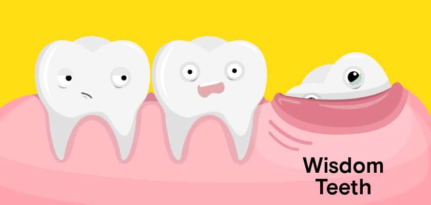 wisdom teeth pain illustration