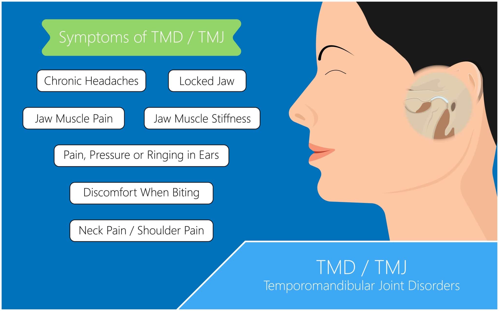 Symptoms of TMJ Disorder infographic temporomandibular joint